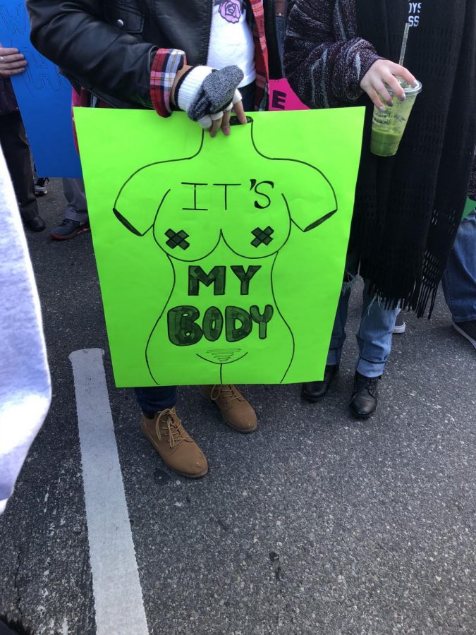 Women rests her arm while holding amazing sign